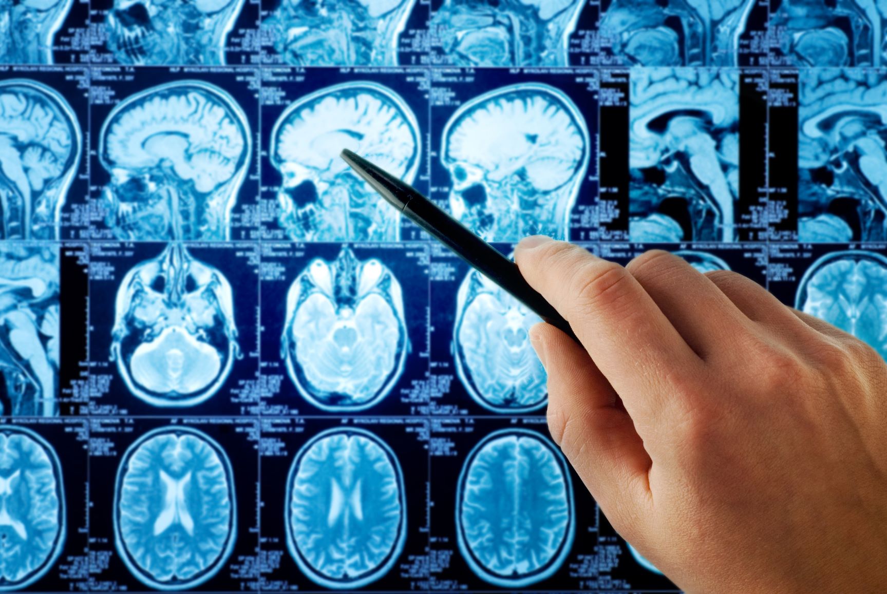 MRI