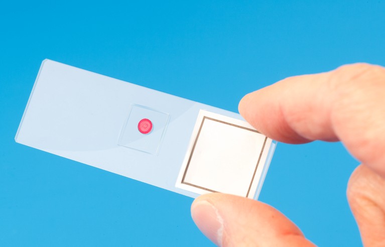 Blood and tumour samples will be analysed to determine the effect of aspirin on cancer in the ASPREE Cancer Endpoints Sub-study